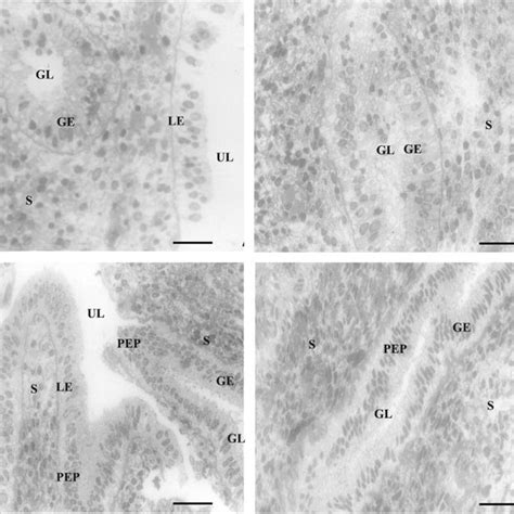 Ultrastructural Features Of Endometrial Glandular Epithelium From B