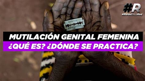 Mutilación Genital Femenina ¿qué Es ¿por Qué Se Realiza ¿en Qué Países Se Practica Youtube