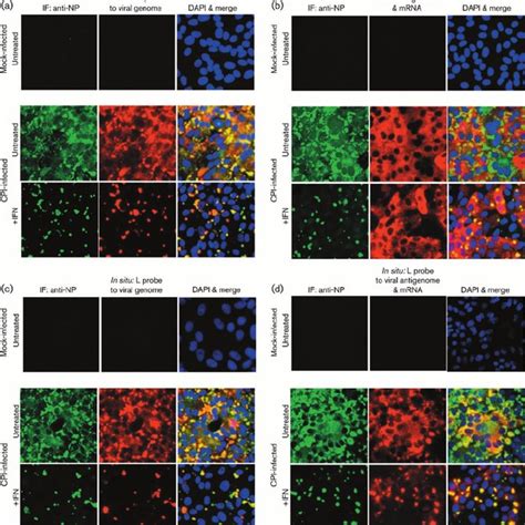 The M Protein Is Present In Cytoplasmic Inclusions In Rsv Infected