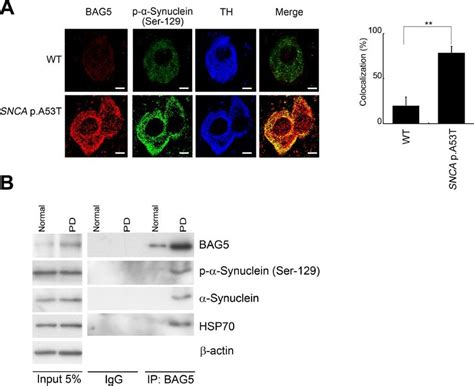 Bag5 Is Increased And Colocalized With α Synuclein In Snca Pa53t Mice