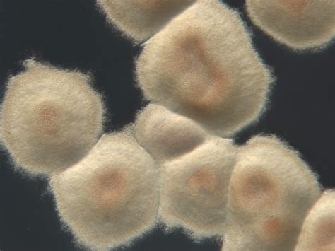 ESA Streptomyces Colony At Leiden University