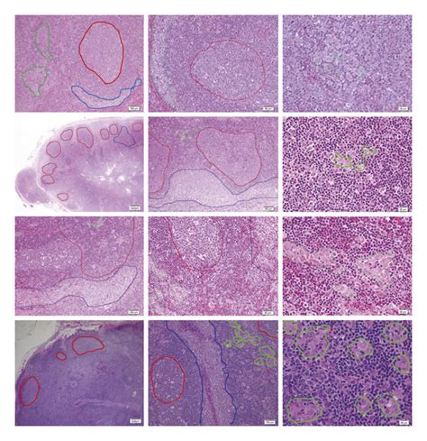 Microscopic Findings Of Hematoxylin Eosin Stained Lymph Nodes In Four