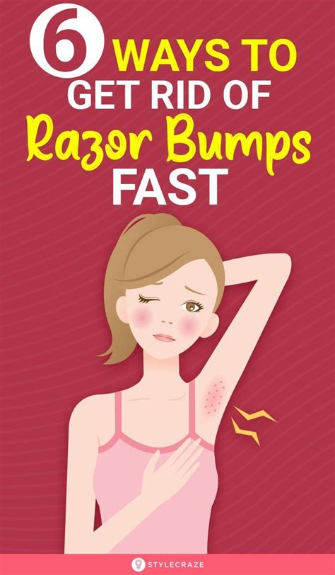 Ways To Get Rid Of Razor Bumps Fast