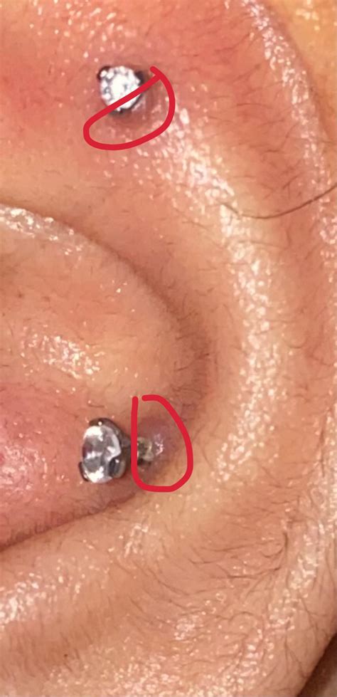 Bump On The Center Of My Conch And Flat Piercings I Got This Pierced