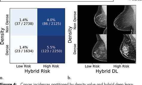 Figure 4 From A Deep Learning Mammography Based Model For Improved