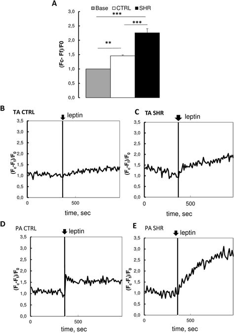 Measurement Of Cytosolic Calcium Concentration After Leptin Treatment