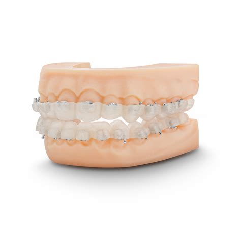 Tpo Dib Typodont Web Res Tp Orthodontics