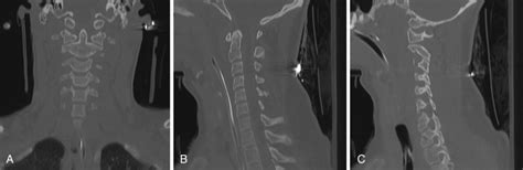 The Cervical Spine Radiology Key