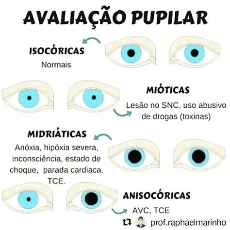 Avalia O Pupilar Enfermagem Estudante De Enfermagem Tecnico Em