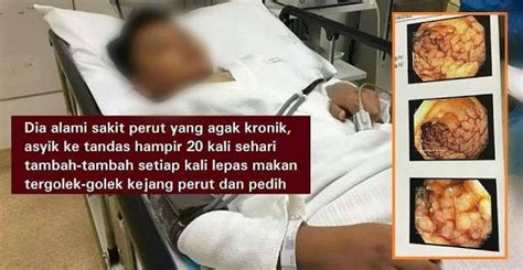 Terlalu Banyak Makan Junkfood Apa Doktor Jumpa Dalam Perut Budak Ni