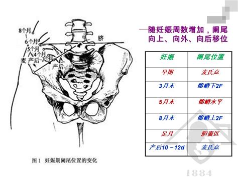 妊娠合并外科疾病 熊 钰 复旦大学附属妇产科医院 妊娠期急性腹痛 妊娠并发症 流产 异位妊娠 黄体破裂 早产、临产 胎盘早剥 子宫破裂