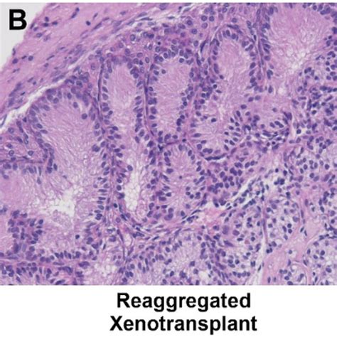 Re Aggregated Rat Fetal Testis Xenotransplants Display Development Of