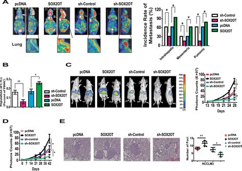 Effect Of LncRNA SOX2OT On In Vivo Tumor Metastasis Of HCC Cells A The