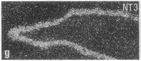 Bright Field A And B And Dark Field C H Photomicrographs Of Neurons