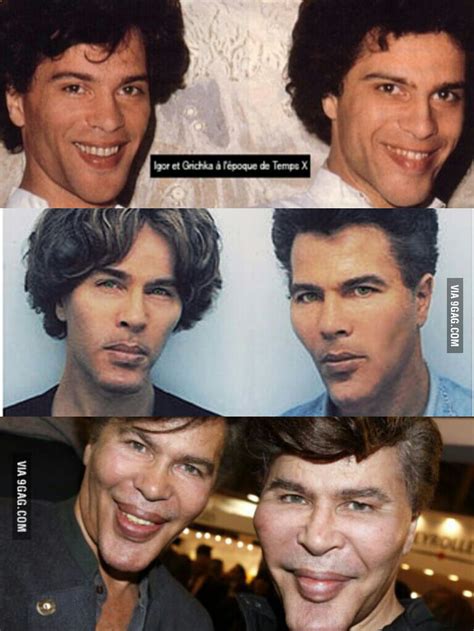 This Is The Transformation Of The Bogdanov Twins Puberty Done Wrong 9GAG