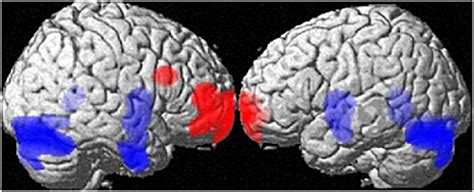 Frontiers Sex Hormones And Gender Role Relate To Gray Matter Volumes