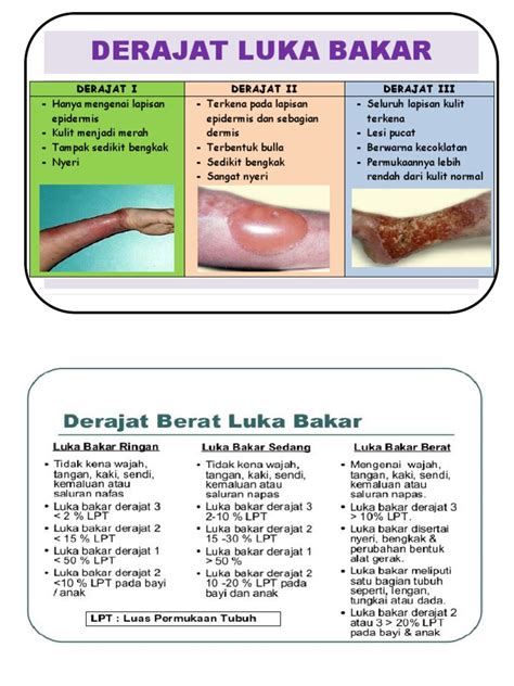 Derajat Luka Bakar Pdf