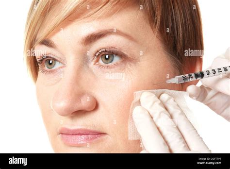 Hyaluronic Acid Injection For Facial Rejuvenation Procedure Stock Photo