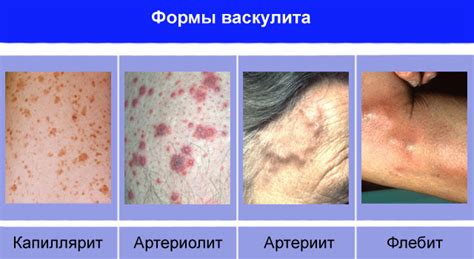 Ацекардол: инструкция по применению, цена, отзывы, аналоги и показания