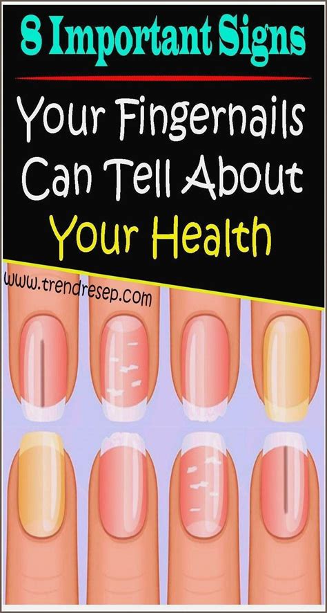 8 Important Signs Your Fingernails Can Tell About Your Health Artofit