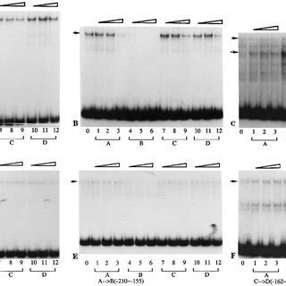 Gel Mobility Retardation Assay Of Protein DNA Complexes End Labeled