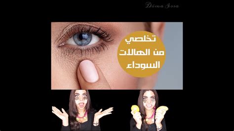 تخلصوا من الهالات السوداء بسهولة ️goodbye To Under Eyes Dark Circles