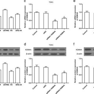 The Expression Of Kdm A In Glioma Cells The Expression Of Kdm A In