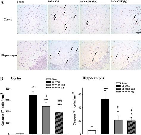 Less pronounced cellular apoptosis at the cortex and hippocampus after ...