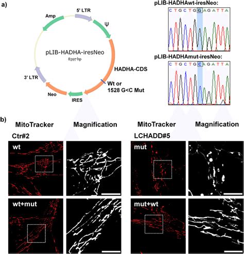 Expression Of Wild Type HADHA In LCHADD Patient Derived Fibroblasts