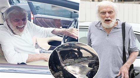 Dick Van Dyke 97 Shows Off Injuries In First Pics Since Car Crash