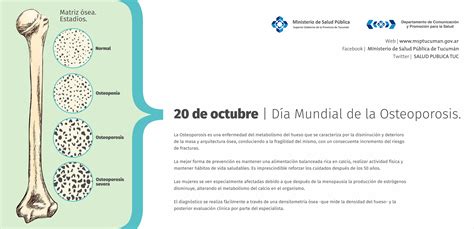 D A Mundial Osteoporosis Ministerio De Salud P Blica De Tucum N