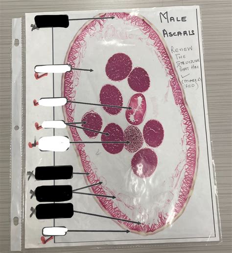 Male Ascaris Diagram Quizlet