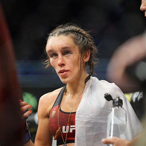 Joanna Jedrzejczyk Head Swelling Knockout Next Fight Sportsjone