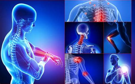 Enfermedades Osteoarticulares