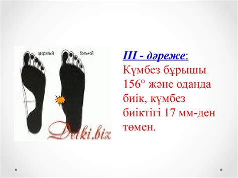 Табан күмбездері. Жалпақтабандылықт - online presentation