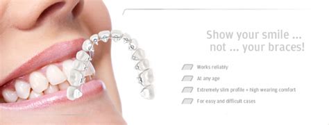 Lingual Braces Pros And Cons