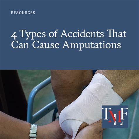 Accidents That Can Cause An Amputation Injury