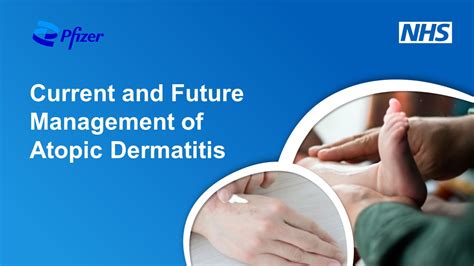 New Programme On Managing Atopic Dermatitis Now Available Elearning For Healthcare