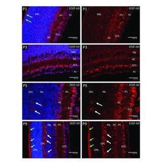 Confocal Micrographs Showing Immunostaining For HIF 1a In Postnatal