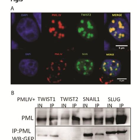 A Confocal Images Of Co Localisation Between PML Isoform IV Fused To