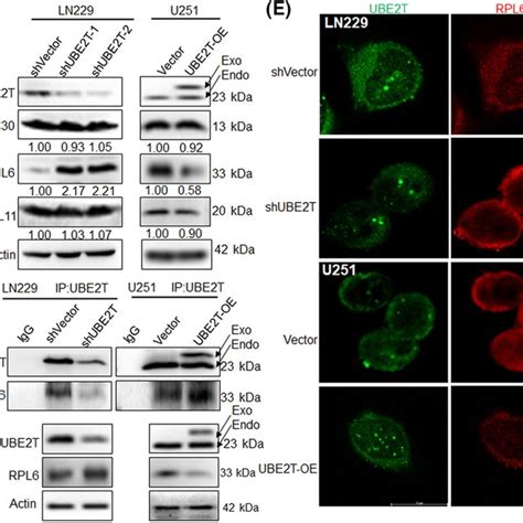 Ube T Interacts With Rpl In Glioblastoma Gbm Cells A Schematic