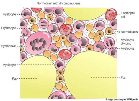 How Myelofibrosis Affects Your Body Med Q Pill Dispenser