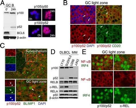 Transcription Factors Of The Alternative Nf B Pathway Are Required For