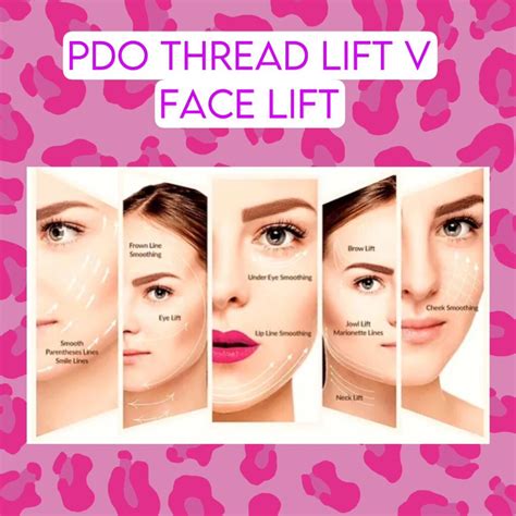 pdo thread lift revolutionary  surgical face lift beauty