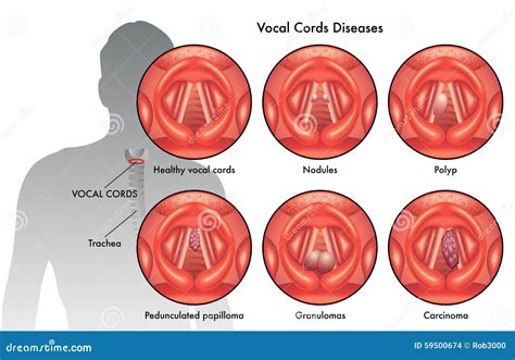 Vocal Cord Vocal Folds Vibratory Cycle Royalty-Free Stock Photo ...