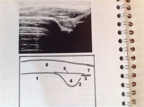 Sonographie Ellbohengelenk Karteikarten Quizlet