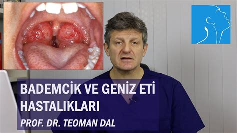 Bademc K Ve Gen Z Et Hastaliklari Prof Dr Teoman Dal Youtube