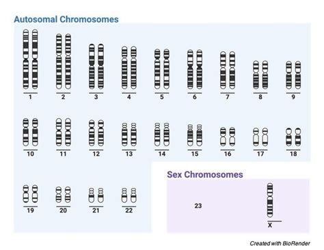 Turner Syndrome: Symptoms, Causes, Diagnosis, and Treatment