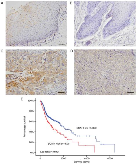 Bcat1 Overexpression Regulates Proliferation And C‑mycglut1 Signaling