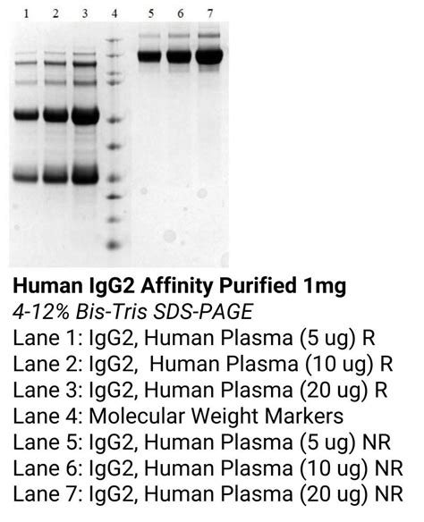 human igg affinity purified innovative research
